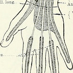Do you ever see elements of beauty when you insert IVs?